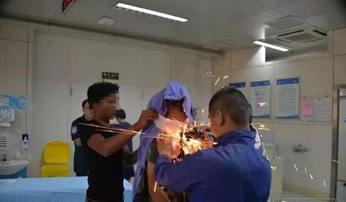 驚險！濱州一小伙嘴里插進1.5米鋼筋 濱醫(yī)附院多科室聯(lián)合手術3小時取出