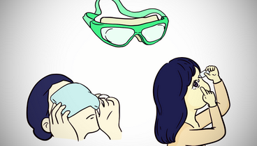 春季過敏性結(jié)膜炎進入高發(fā)期｜山東大學齊魯醫(yī)院德州醫(yī)院專家提醒：揉眼止癢存感染風險 科學防治需雙管齊下