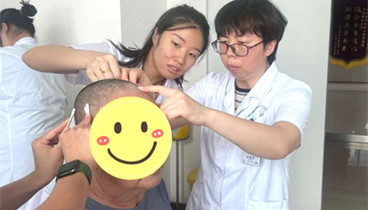 濱州醫(yī)學(xué)院煙臺(tái)附屬醫(yī)院岐黃腦針：聚焦腦卒中后遺癥康復(fù)，解鎖中醫(yī)精準(zhǔn)治療新高度