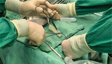 濟(jì)寧醫(yī)學(xué)院附屬醫(yī)院婦科成功開(kāi)展人源脫細(xì)胞異體真皮補(bǔ)片陰道成形術(shù)